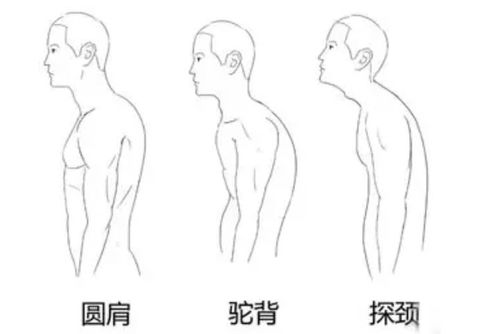 荒野健康 上班族日常有哪些方法可以缓解肩颈后背的疲劳