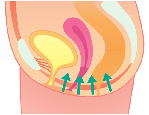 改善漏尿 尿频,阻止盆底肌老化,日本妇产科医生教你用矿泉水瓶训练