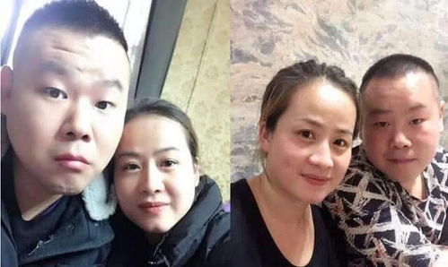 无畏大脸特效怎么弄好看 你知道为什么岳云鹏老婆剃光头么怎么看