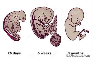 多囊卵巢综合征患者在供卵试管移植后要如何保胎