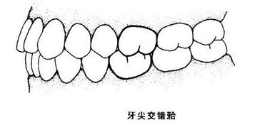 牙列与牙齿的咬合有什么关系 