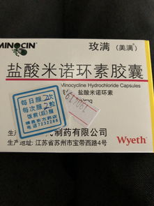 买药时遇到同一个药不同的品牌时怎么选之前那种没有，还买吗(同一种药不同厂家)