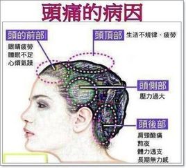 头痛的中医治疗效方6则