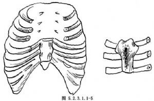 胸骨部分或全部切除与重建