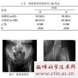 骨折毕业论文