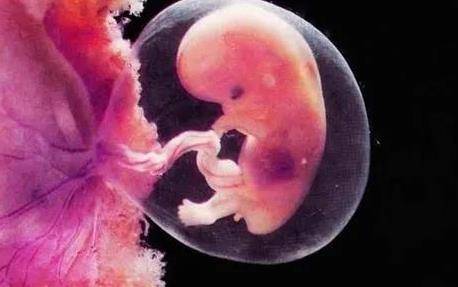 胎儿畸形是什么原因造成的(婴儿畸形是什么原因导致的)