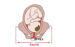 孕妈要注意了,这件事虽然痛,但真的非常重要