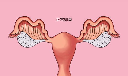 女性应该谨防卵巢“阴萎”(女孩卵巢功能衰退可以治吗)