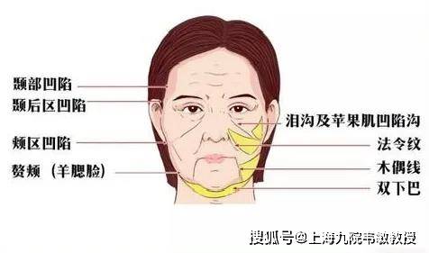 九院韦敏教授丨警惕面部初老征兆,如何用医疗美容方式改善