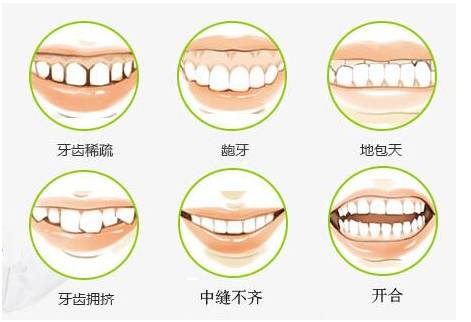 牙齒矯正后容易松動(dòng)嗎