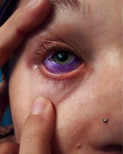女子眼球纹身失败,从此眼睛会流出 紫色 的眼泪