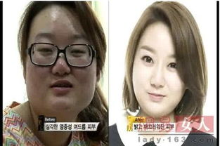 韩国双胞胎整容变女神逆袭 盘点整容改变命运的女星们