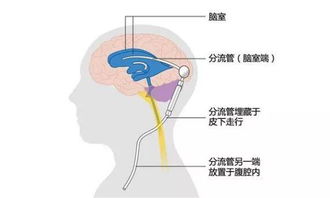 西北大学附属医院 西安市第三医院神经外科五大专病门诊