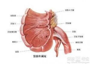 阑尾炎手术步骤