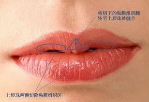 唇部专题 口唇部的比例与美学标准