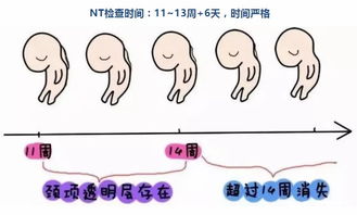 孕妇第一次产前检查很重要,为啥要做NT检查 这个原因要搞清楚