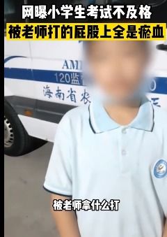 海南一小学老师,因学生不及格,竟用棍子将其臀部打得肿胀发紫