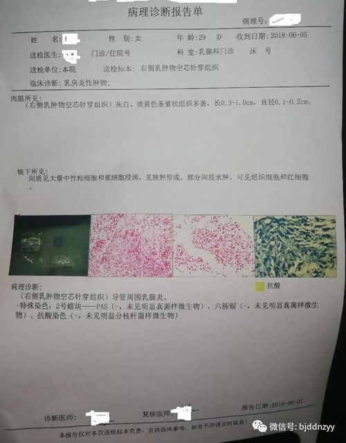 计算机图文报告病理是什么,看不懂自己的病理报告单 我来告诉你怎么看