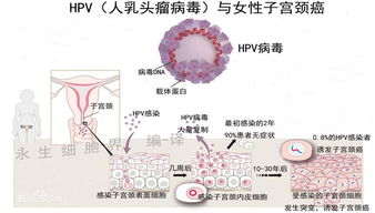 关于宫颈HPV你不知道的秘密