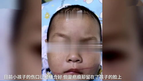 湖南女子因举报乱倒垃圾一家4口被砍,2岁孩子面部被砍露两排腮腺