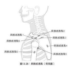 女性后肩胛骨部位酸痛怎么治疗右肩膀酸痛是怎么回事(女人右侧肩胛骨后背疼是什么原因)