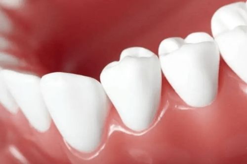 一定要好好预防 就是这7个原因导致你的牙齿脱落