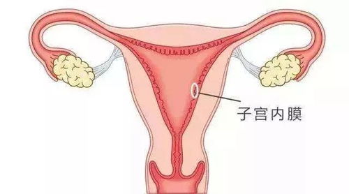 备孕科普 子宫内膜薄,我能怀孕吗