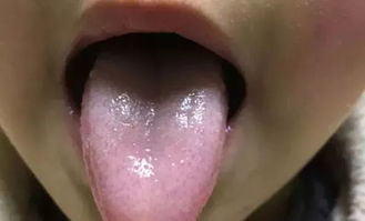 舌苔发黄是什么原因 舌苔发黄怎么回事