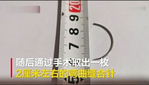 产妇生子5个月后发现体内有针头 医院不给说法 反问想要多少钱