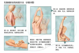 乳腺钼靶X线检查的注意事项有哪些