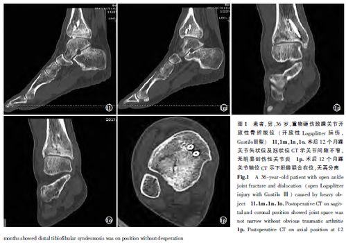 花核肿胀无法闭合 情愫暗生骨科全文阅读