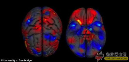 剑桥科研人员发现大脑容量和结构存在明显两性差异