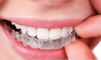 怎么样修复牙齿缝隙