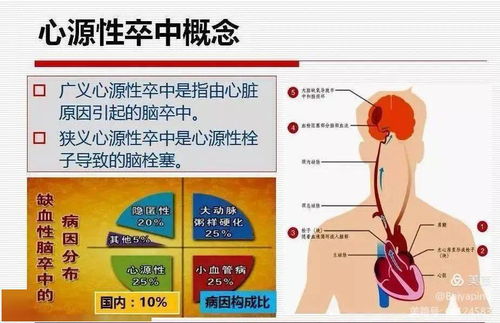 什么是房颤(什么是房颤消融手术)