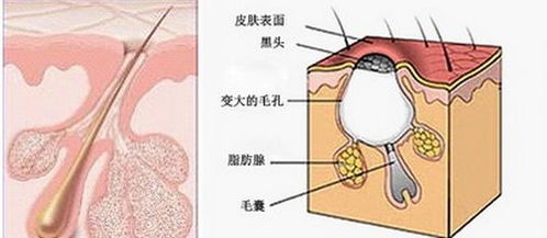 打败毛孔 下一个反 孔 精英就是你