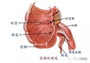 饭后运动真的是阑尾炎的元凶吗 