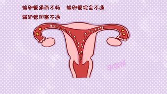 原创女性常做5件事，可能会使输卵管堵塞，想要宝宝的注意了