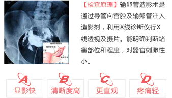 南京玛丽生殖孕育中心医院：输卵管积水患者多年不孕，来玛丽三月迎接好孕！