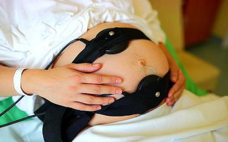 孕晚期最担心的胎心监护，了解这4点很重要