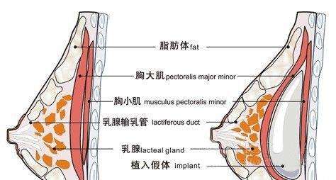 这界的大冷门有哪些