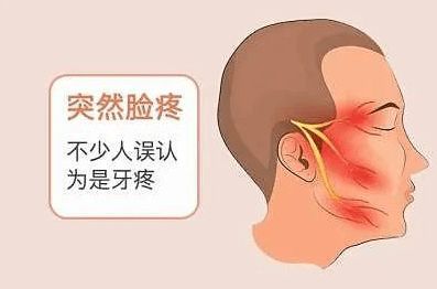 牙疼和三叉神经痛的区别在哪