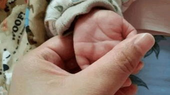 刚出生的婴儿断掌是怎么回事,新生儿断掌纹怎么回事