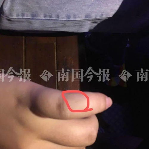 广西女子餐馆吃饭时,天花板掉下活老鼠,还抓伤人 店老板说...