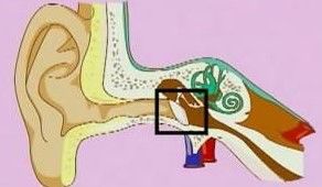 耳朵流水是什么回事 须提防鼓膜穿孔