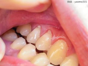 善水药墨讲解 齿 龈与肾 肠胃的关系 