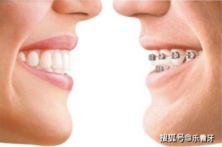 北京国医康牙齿矫正需要多少钱