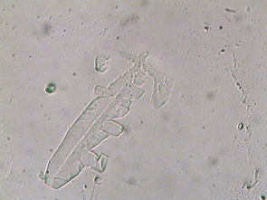 400倍显微镜下的寄生虫 信息图文欣赏 信息村 K0w0m Com