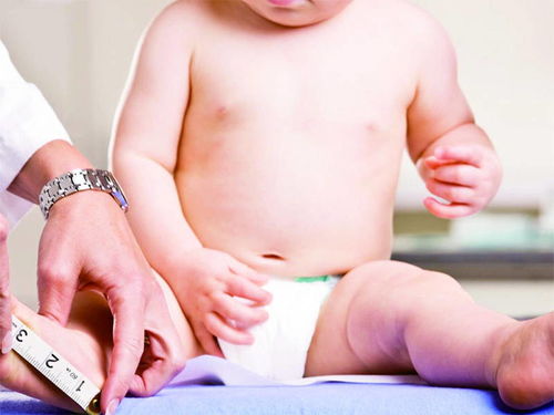 一岁半的宝宝基本具备哪些能力和特征了 体检时都要查些什么