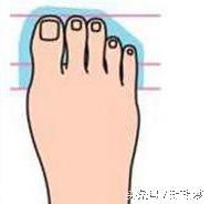 透过脚趾看命运,你的脚趾什么形状呢