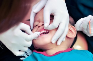 孩子牙齿摔掉泡牛奶 有龋齿可能是父母嘴对嘴亲吻导致的 